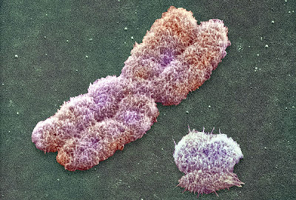 chromosomes under a microscope